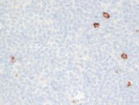 CD15-negative-in-HRS-cells