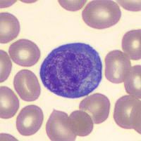 Reactive lymphocyte