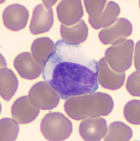 Reactive lymphocyte