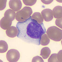 Reactive lymphocyte