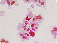 Bipolar staining of gram-negative bacillus in cerebrospinal fluid