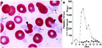 Cryoglobulins mimicking platelet recovery in a mantle cell lymphoma patient treated with chemoimmunotherapy