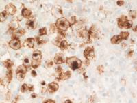 GZL-CD15-IHC