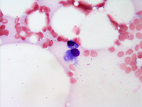 plasma cell versus osteoblast on bone marrow