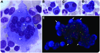 This is not an osteoclast