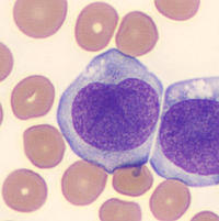 Promonocytes