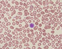 giant-platelets