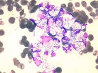 Intracellular bacteria on peripheral blood smear