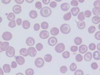 Taget cells