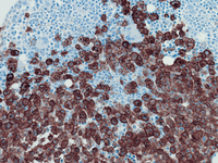 CD117 IHC