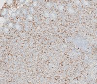 CD56 immunostain