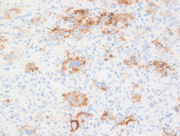 CD20 immunostain