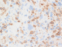 CD3 immunostain