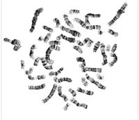 Image showing metaphase, processed metaphase and Karyotype 1