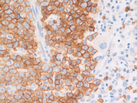 MPN-JAK2PCM1GlycophorinC