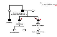 MDS with germline GATA2 mutation