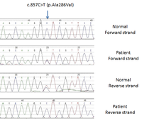 Myeloid-NeoplasmGATA2Sanger