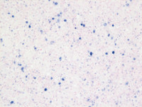 EBV-reactivationEBER