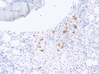 CD30 immunostain