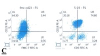 Chronic lymphocytic leukemia (CLL) with presence of pro-lymphocytes 8