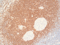 HVCD-IgD IHC