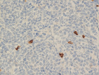 IHC CD8