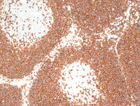 Mantle cell lymphoma with mantle zone pattern-7