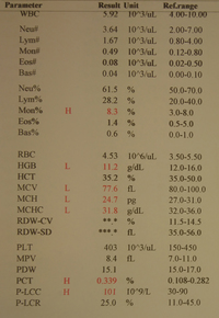 Dimorphic anemia presentation in patient with iron deficiency 1