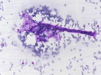 Capillary endothelial cells