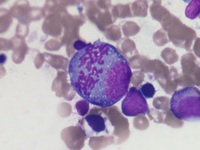 endomitosis in malignant plasma cell