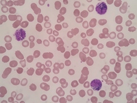 Pigment in neutrophils and myeloid cells 1