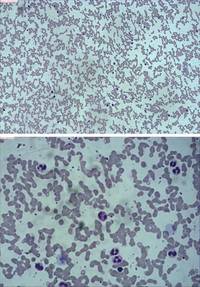 Peripheral Blood Smear - Post Incubation at 37 deg. C