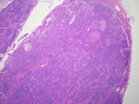 Lymph node; H&E; 20X objective.