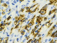 CD117 immunostain; 1000X oil objective.