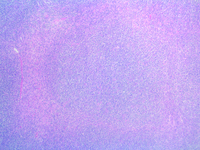 ReferenceCase-Reena-09122021 - Image1