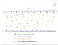 Prothrombotic and pro-adhesive blood milieu in the MPNs 1b