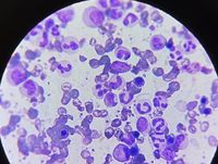 Ref Case Expert 151221