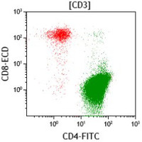 Sezary-syndromeImmunophenotype