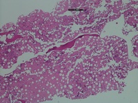 Test Reference case editor unit testing