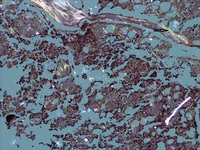 Test Reference case editor unit testing