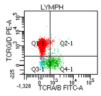 T-LGL leukemia - Flow - Figure 6