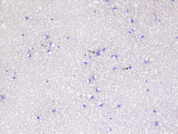 TAM smear - Fig 2