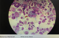 Reference case for bug fixes 1