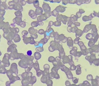 Plasmodium falciparum trophozoites 2
