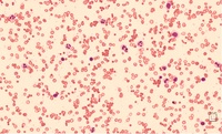 RBC agglutination