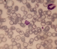 Schizont, Plasmodium Vivax