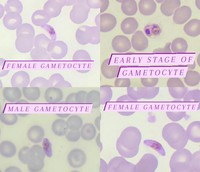 Plasmodium falciparum gametocytes 2