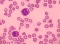 IE ADMIN PUBLISHES THE IMAGE UPLOADED BY EXPERT (SENT BY EDITOR)