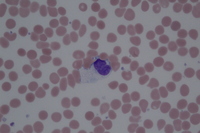 Mast cells in peripheral blood