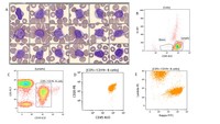 CD5+ Innate-like B cells (aka B1a cells)